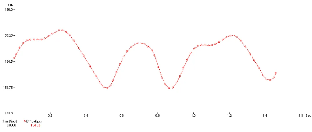 Figure 4. Vertical amplitudes of the left sitting point in free walk 