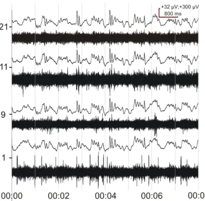 Figure  3.    Neural  signal  recorded  from  the  CPu  of  a  KX  anesthetized  rat  with the probe described in thesis point I.2