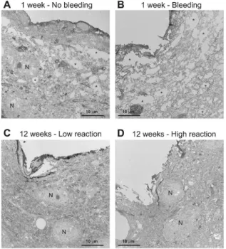 Figure 7.  Transmission electron micrographs of the probe tracks 1 and  12  week  after  implantation  in  the  presence  of  bleeding  (A),  without  bleeding  (B),  in  the  presence  of  low  (C)  or  high  (D)  immunoreaction