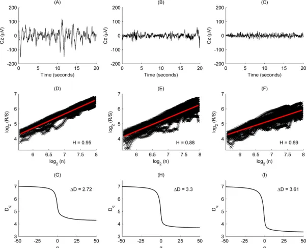 Figure 2.1.  (A-C) Examples of EEG segments recorded from subject #16 during sleep stages NREM4 (A),  NREM2 (B) and REM (C)