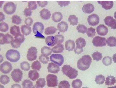 Figure 5. Babesia canis in a Giemsa-stained thin blood smear. 