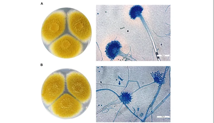 FIGURE 1 | Macro- and micromorphology (after lactophenol cotton blue staining) of A. tamarii (A) SZMC 2439 and (B) SZMC 2393 grown on potato dextrose agar plates for 5 days at 37 ◦ C