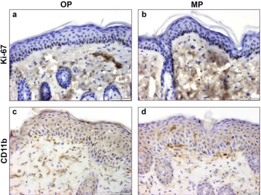 Figure 3.  Comparison of Ki-67 or CD11b immunoreactivity of Aldara-treated dorsal skin samples of C57BL/6  mice using OP or MP