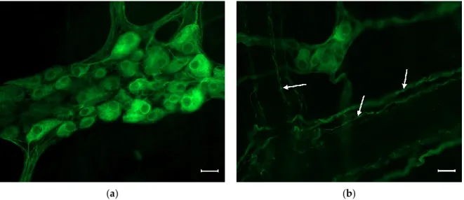 Figure  1.  Representative fluorescent micrograph of a myenteric (a) and a submucous (b) ganglion  from the duodenum of a control rat after peripherin immunolabelling