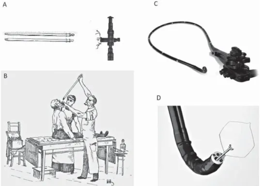 1. ábra. Merev endoszkóp alkalmazása (A, B). Videoendoszkóp (C) munkacsatornájában  biopsziás csípő és polipektómiás hurok (D)