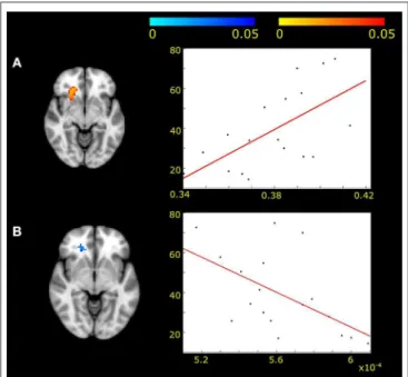 FIGURE 3 | Positive correlation was found between fractional anisotropy and frontal white matter activity fluctuations (A) (p &lt; 0.05, corrected for multiple correlations) in MWA patients