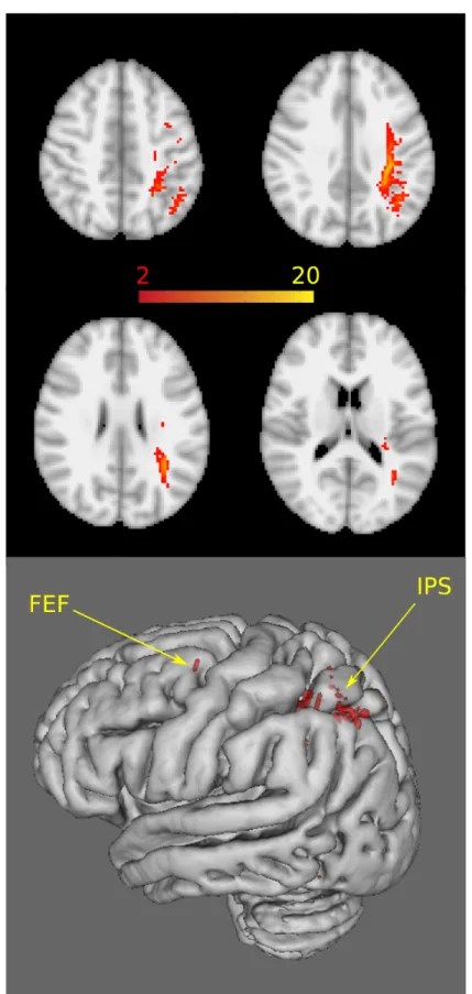 Fig 4. The connectivity of the cluster showing correlation between FA and behavioural data