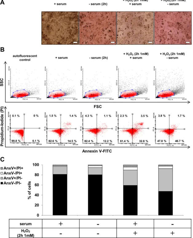 Figure 2. The effect of serum deprivation and H 2 O 2  co-treatment on the morphology and cell viability  of hESC-RPE cells