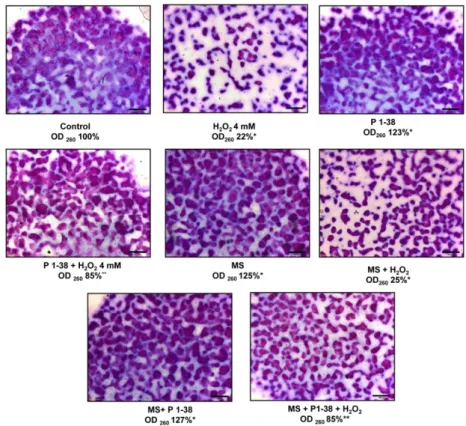 Figure 4. Effects of PACAP and/or oxidative stress and/or mechanical stress (MS) on metachromatic  cartilage formation