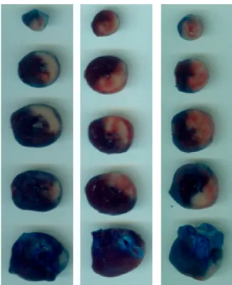 Figure 14. Representative photographs of transversely sectioned Evans-blue perfused, triphenyltetrazolium chloride (TTC)—stained heart tissues, outlining the area at risk (AAR; sum of white and red area); blue, healthy viable tissue; pale white, infarcted 