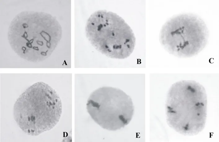 Fig. 2. (A) Prophase I: PMC showing1 IV  + 9-ring II  + 1-rod II;  (diakinesis); (B) Anaphase I: 1-laggard, unsynchronized  movement of chromosomes; (C) Anaphase I: single chromatin bridge; (D) Anaphase I: unsynchronized movement of  chromosomes; (E) Metap