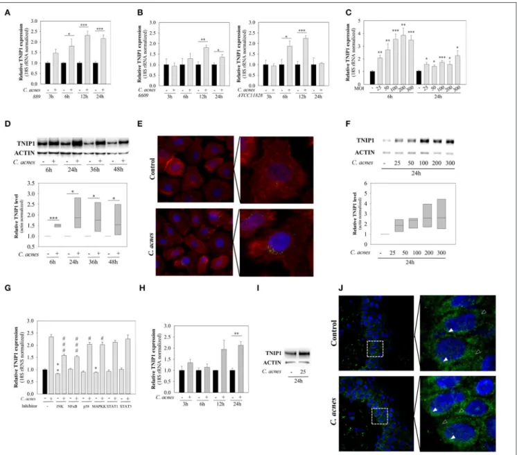 FIGURE 1 | mRNA and protein expression of TNIP1 increases in response to C. acnes treatment