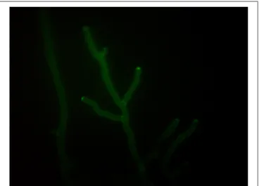 FIGURE 1 | Hyphae of Trichoderma pleuroti expressing the green fluorescent protein (photo: Lóránt Hatvani).
