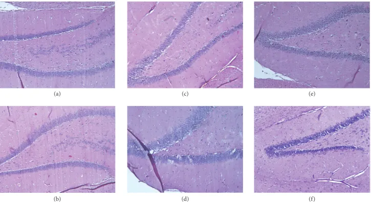 Figure 4: Hematoxylin-eosin stained sections (100x magnification). (a-b) Hippocampus of a young control male and a female animal, respectively