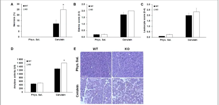 FIGURE 5 | Characterization of acute pancreatitis in AQP1 knock out mice. (A) Pancreatic cell necrosis, (B) edema, (C) leukocyte infiltration, and (D) serum amylase activity (U/l) were measured in wild-type (WT) and AQP1 knock out (KO) mice after induction