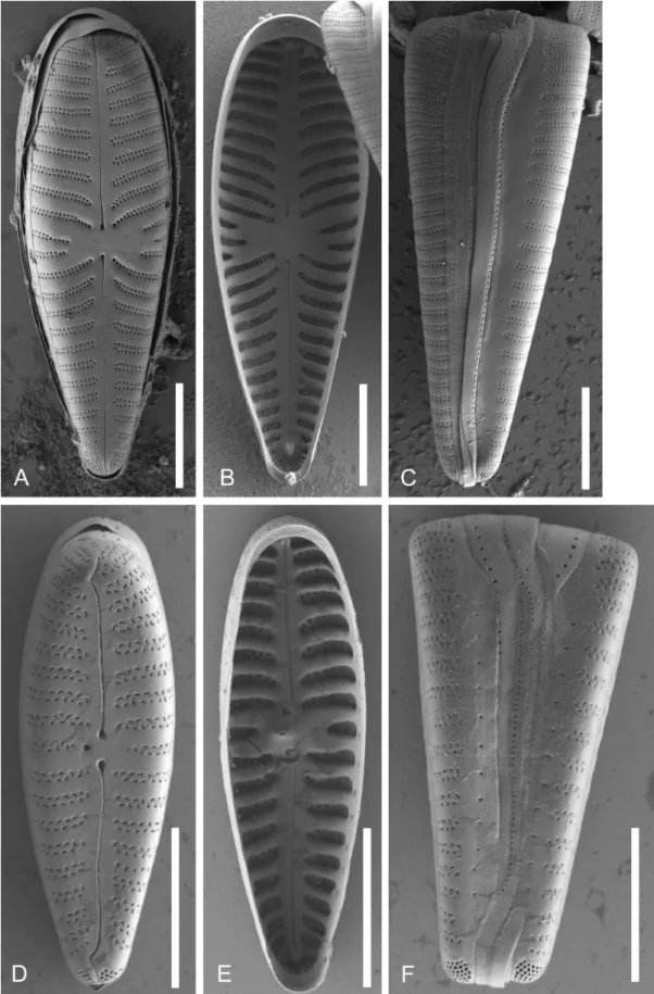 Figure 5 – SEM-comparison of autapomorphies: A–C, Gomphonella olivacea, C_A9208 lectotype population; D–F, Gomphonema minutum,  strain D191_005