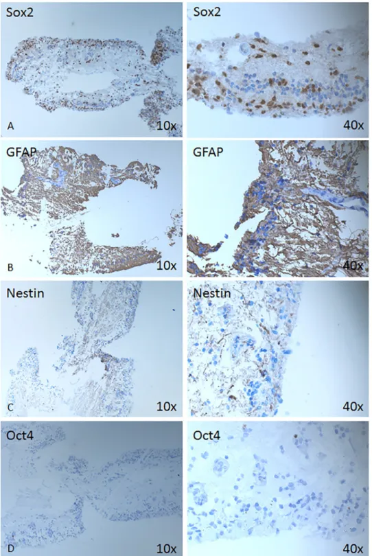 Fig 3. Expression of stem/progenitor cell-, neuro-glial markers. Immunohistochemical analysis is shown against Sox2 (A), GFAP (B), Nestin (C) and Oct4 (D) at magnification 10X (left column) and 40x (right column).