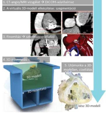 2. ábra A háromdimenziós modellek készítésének lépései a képalkotás- képalkotás-tól a nyomtatásig (a részleteket lásd a szövegben)