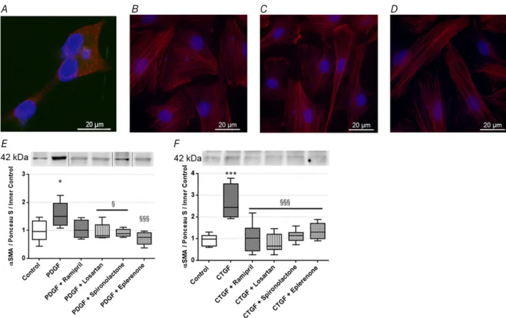 Figure 6. Effect of profibrotic factors and renin-angiotensin-aldosterone system inhibitors (RAASi) on normal rat kidney fibroblast (NRK-49F) cells