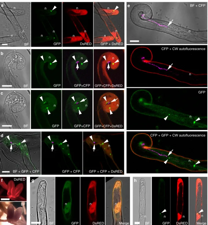 Fig. 3 Subcellular localization of VPY during rhizobial infection. a – e Live cell confocal images showing localization of VPY-GFP driven by VPY promoter in root hairs at different stages of rhizobial infection