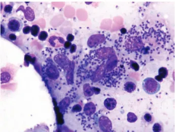 Figure 1. Leishmania phagocytosed by the macrophages in bone marrow blood smear