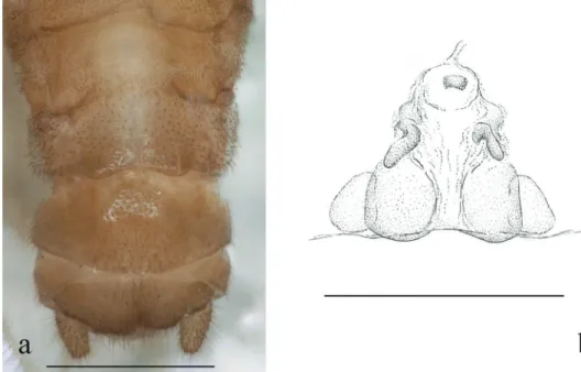 Figure 9. Indonemoura scalprata (Li &amp; Yang, 2007) (female) a terminalia, ventral view b inner genitalia,  dorsal view
