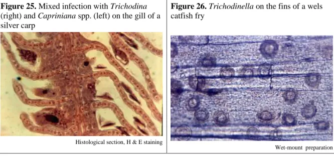 Figure 25. Mixed infection with Trichodina  (right) and Capriniana spp. (left) on the gill of a  silver carp