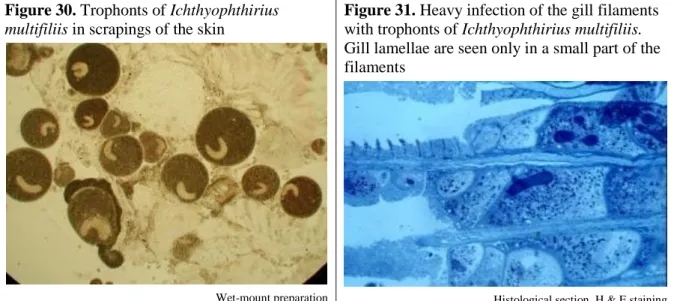 Figure 30. Trophonts of Ichthyophthirius  multifiliis in scrapings of the skin