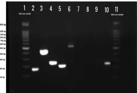 Figure 1. PCR assay pro ﬁ le with Shigella reference strains. Lane 1: 100 bp DNA marker; Lane 2: