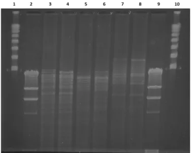 Figure 4. Plasmid restriction fragment length polymorphism of pABC106-NDM and pOMABC109- pOMABC109-NDM