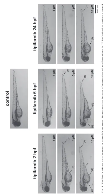 Fig. 5. Tipifarnib affects development in zebrafish embryos. Representative images of morphological malformations in 72 hpf zebrafish embryos treated  with tipifarnib at 2, 6 or 24 hpf