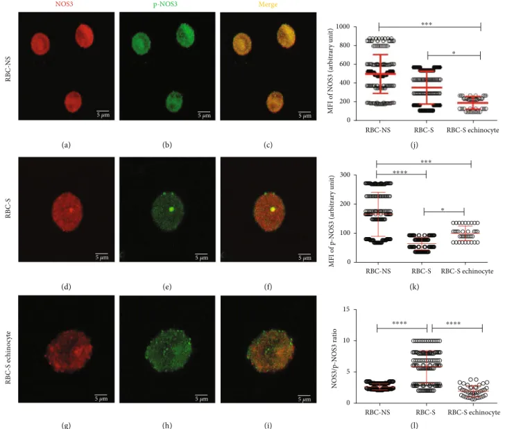 Figure 3: Visualization of the confocal images with varying morphology in relation to the phosphorylation of NOS3 in RBC-NS and RBC-S populations