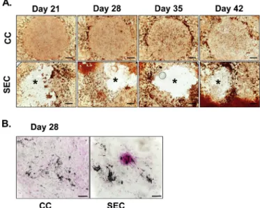 Fig. 4. A. Calci ﬁ ed matrix depositions in hMSCs cultured in osteogenic medium for 21, 28, 35 and 42 days