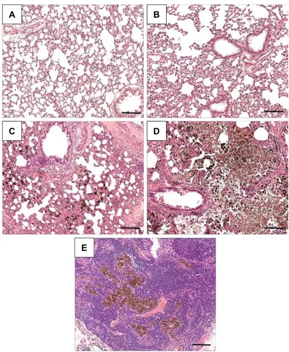 Figure 5 h&amp;e-stained sections of lung (A–D) and hilar lymph-node (E) tissue from animals in groups c (A), VT (B), lD (C), and hD (D, E).