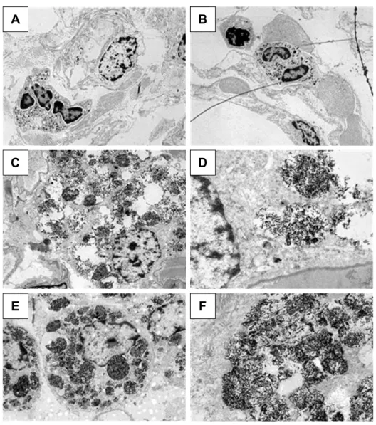chemically (Figure 2, Table 3) and by electron microscopy  (phagocytosed  NPs  and  conglomerates  in  alveolar   mac-rophages, seen in Figure 6D), but moderate effects of cell  and tissue damage were evoked following in vitro and in vivo  administrations,
