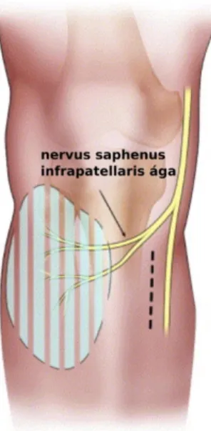 1. ábra  A nervus saphenus infrapatelláris ágának lefutása   (https://www.sciencedirect.com/science/article/pii/S1060187206000219) 