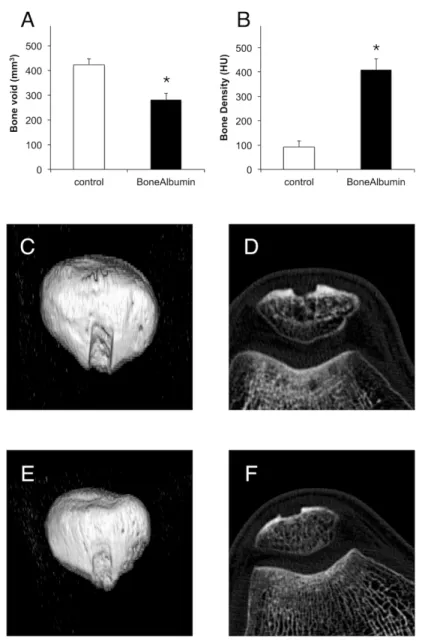 Fig. 5. Morphometric measurements of the patellar site. Panel A shows remaining bone void, while  Panel B shows density of the newly formed bone at 6 months post-operatively