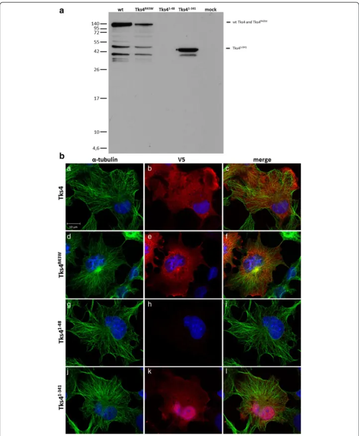 Fig. 8 The expression patterns of Tks4 mutant proteins. 8a, COS7 cells were transiently transfected with V5-Tks4, V5-Tks4 R43W , V5-Tks4 1–48 and V5-Tks4 1–341 constructs