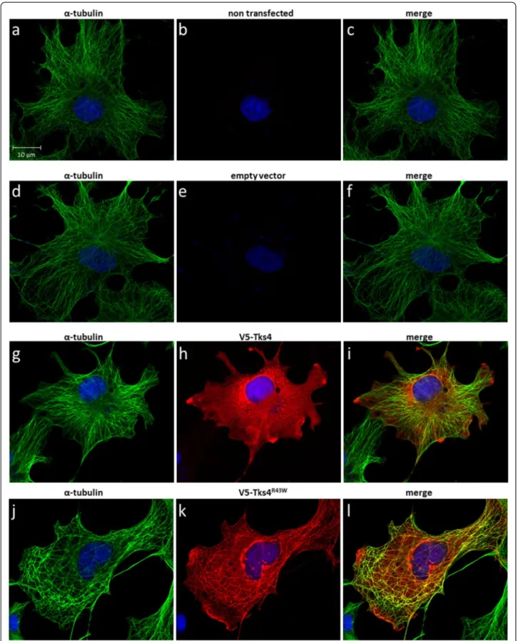 Fig. 3 The Tks4 R43W mutant protein colocalizes with the microtubule network of the cytoskeleton