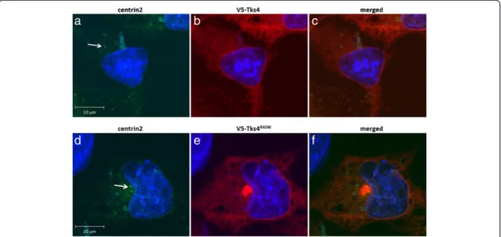 Fig. 5 Aggresomes formed by Tks4 R43W mutant colocalizes with the centrosome. COS7 cells were transiently transfected with hCent2-pEGFP-C1 and V5-Tks4 (5a, b, c) or hCent2-pEGFP-C1 and V5-Tks4R43W (5d, e, f) constructs