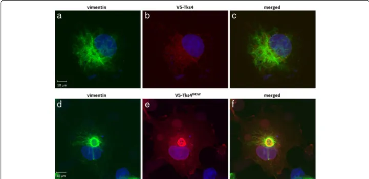 Fig. 6 Tks4 R43W aggresome is encaged by vimentin. COS7 cells were transiently transfected with wild type V5-Tks4 (6a, b, c) or V5-Tks4 R43W (6d, e, f) constructs