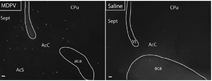 1. ábra Anti-kaszpáz-3 immunhisztokémia frontális irányú agyi metszeteken a nucleus accumbens core (AcC) és schell (AcS) régióiban intraperitonealis  MDPV (bal oldalon) vagy ﬁ ziológiás sóoldat (jobb oldalon) adagolását követően 7 napos egérben