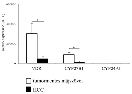 20. ábra VDR, CYP27B1 és CYP24A1 mRNS expresszió összehasonlítása HCC-ben a  környező tumormentes májszövettel (* p &lt;0,05)