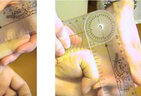 4. ábra – Hüvelykujj MP izületi mozgástartományának mérése szögmérővel 