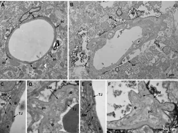 Fig. 3. Low- (A, B) and high magniﬁcation (C-F) electron micrographs of brain capillaries of young adult and middle aged animals
