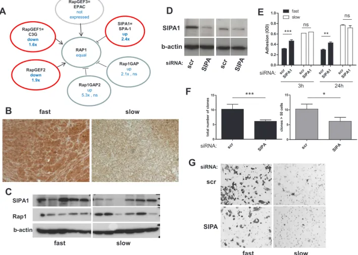 Figure 6: The Rap1 deactivator SIPA1 is gained at the DNA level as well as overexpressed in aggressive melanoma  models and impacts on cell behaviour