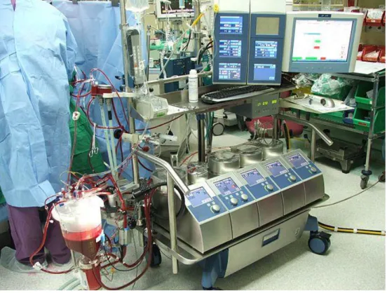 5. ábra: a szív-tüdő motor működése szívműtét közben 