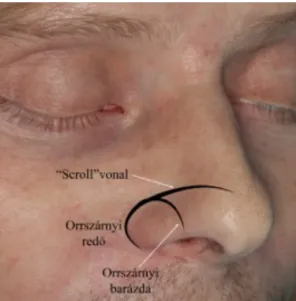 7. ábra – Az orr felszíni anatómiája jobb oldali ferde nézetben 