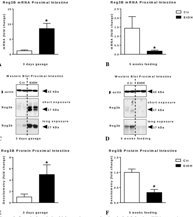 Figure  9.  Intestinal  antimicrobial  protein  expression  in  alcohol-fed  mice.  Wild  type  mice  were  gavaged daily 50% 5g/kg ethanol (EtOH; n=6) or equal amount of saline (Ctr; n=6) for three consecutive  days  or  were  fed  with  5%  ethanol  cont