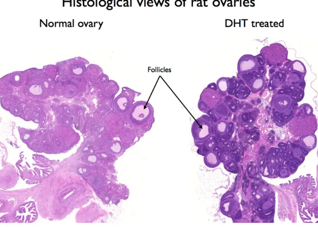Figure 2.: Histological views of whole rat ovaries. A normal ovary is shown on the left side, and a DHT  treated  for  ten  weeks  with  PCO  morphology  (DHT 6